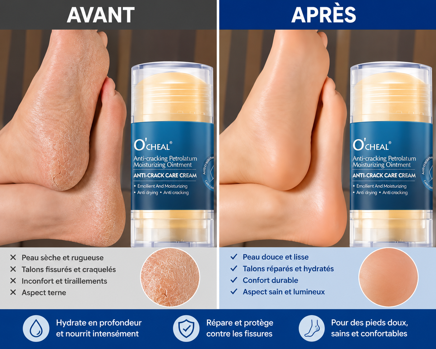 Crème Pieds Anti-Crevasses — Talons Secs & Pieds Abîmés, Hydratation Intense